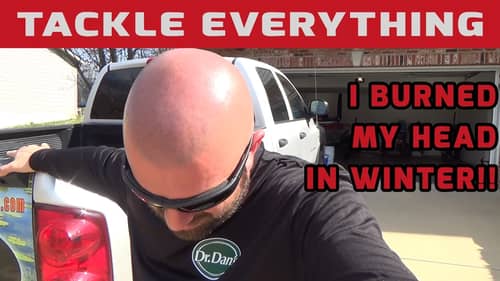 GIVEAWAY - I Burned My Bald Dome! - Let Me Help You Protect Yourself