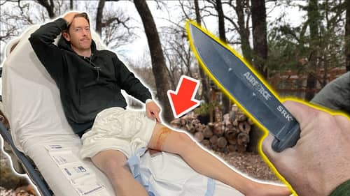 How the Knife Ended Up in My Leg | Answering Comments