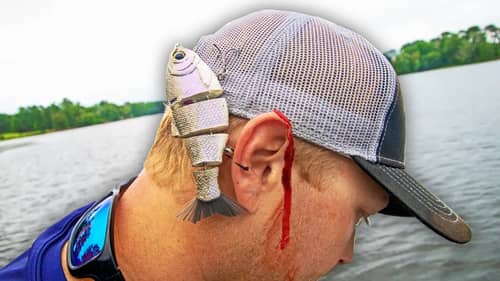 FREAK ACCIDENT!! HOOKED DEEP With A SWIMBAIT!! (INSANE)