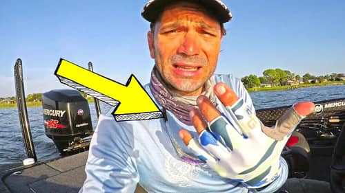 SKIN Cancer SUCKS ~ DISCOVERED new SPECIES of FISH for my LAKE!