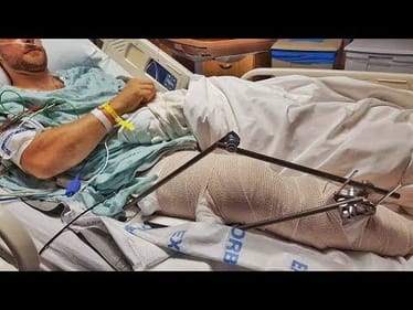 Derek's Update - Surgery Today! Prayers Needed!