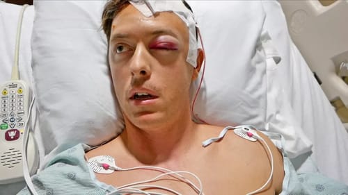 Waking Up After Brain Surgery!