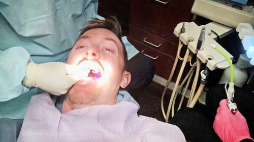 Repairing My Mouth!? FEELS LIKE A HOOKED BASS!