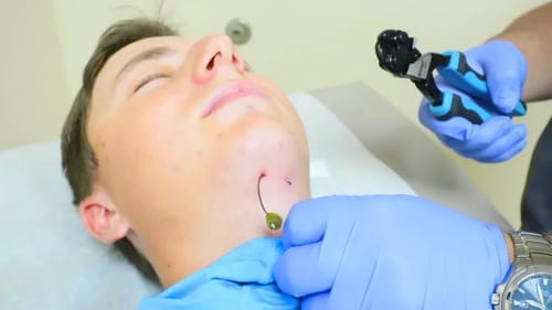 Hook In My NECK (Painful)