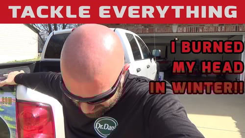 GIVEAWAY - I Burned My Bald Dome! - Let Me Help You Protect Yourself