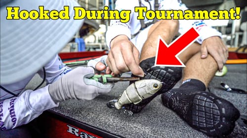 Fisherman's Worst Nightmare! Stepping on a TREBLE HOOK (PAINFUL) we try to yank it out