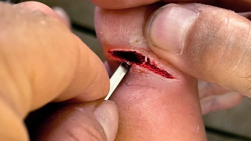 Why You SHOULD Wear Shoes Fishing!