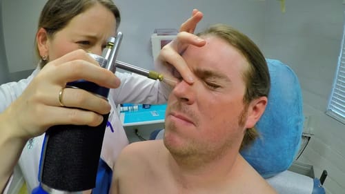Matt's Skin Cancer Operation + Sun Gear Tips