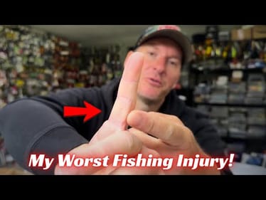 My WORST Fishing Injury! I Ended Up In the Emergency Room!
