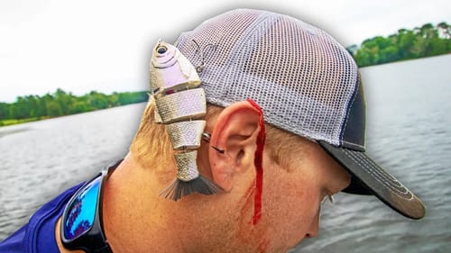 FREAK ACCIDENT!! HOOKED DEEP With A SWIMBAIT!! (INSANE)